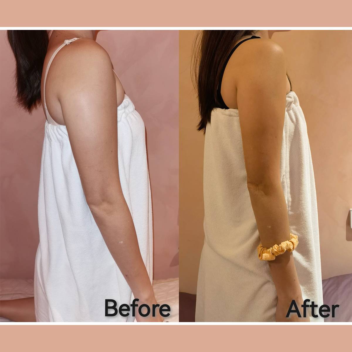 Fat Freeze Trial (3 Sessions) + Consultation Fat Freeze Trial (3 Sessions) + Consultation