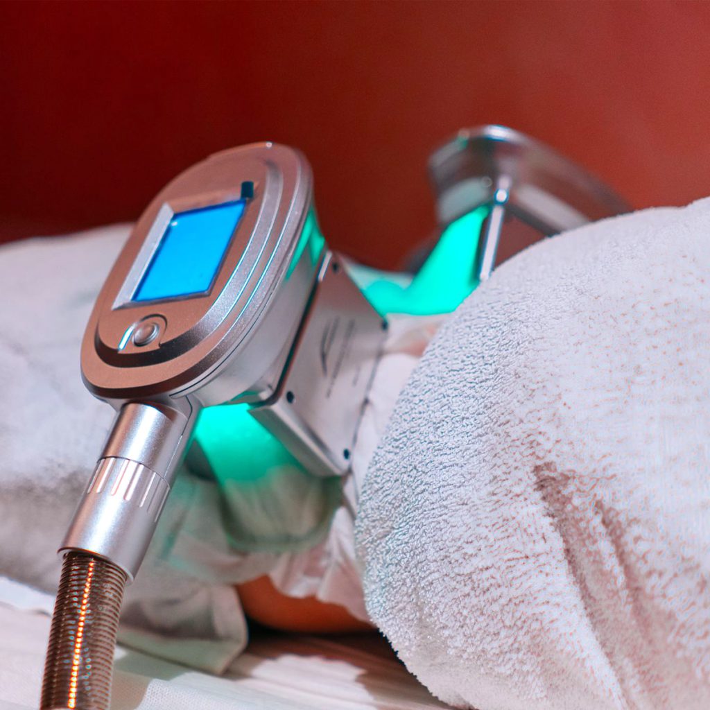 Fat Freeze Trial (3 Sessions) + Consultation FAT HOPE